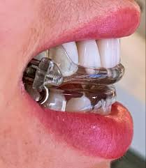 aparelho intra oral para sono